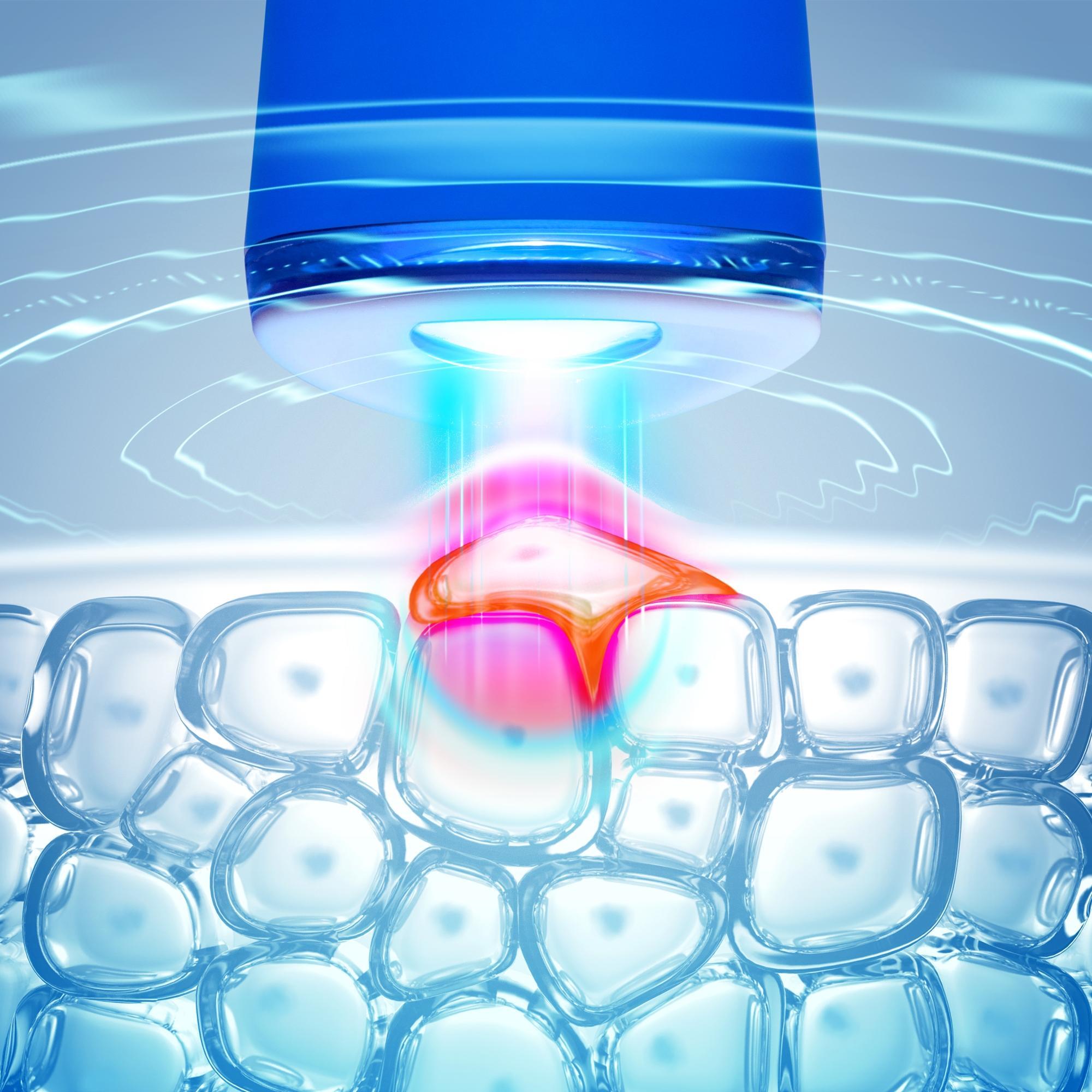 FOREO ESPADA  Akne Karşıtı Cilt Bakım Cihazı, Cobalt Blue