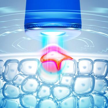  FOREO ESPADA  Akne Karşıtı Cilt Bakım Cihazı, Cobalt Blue