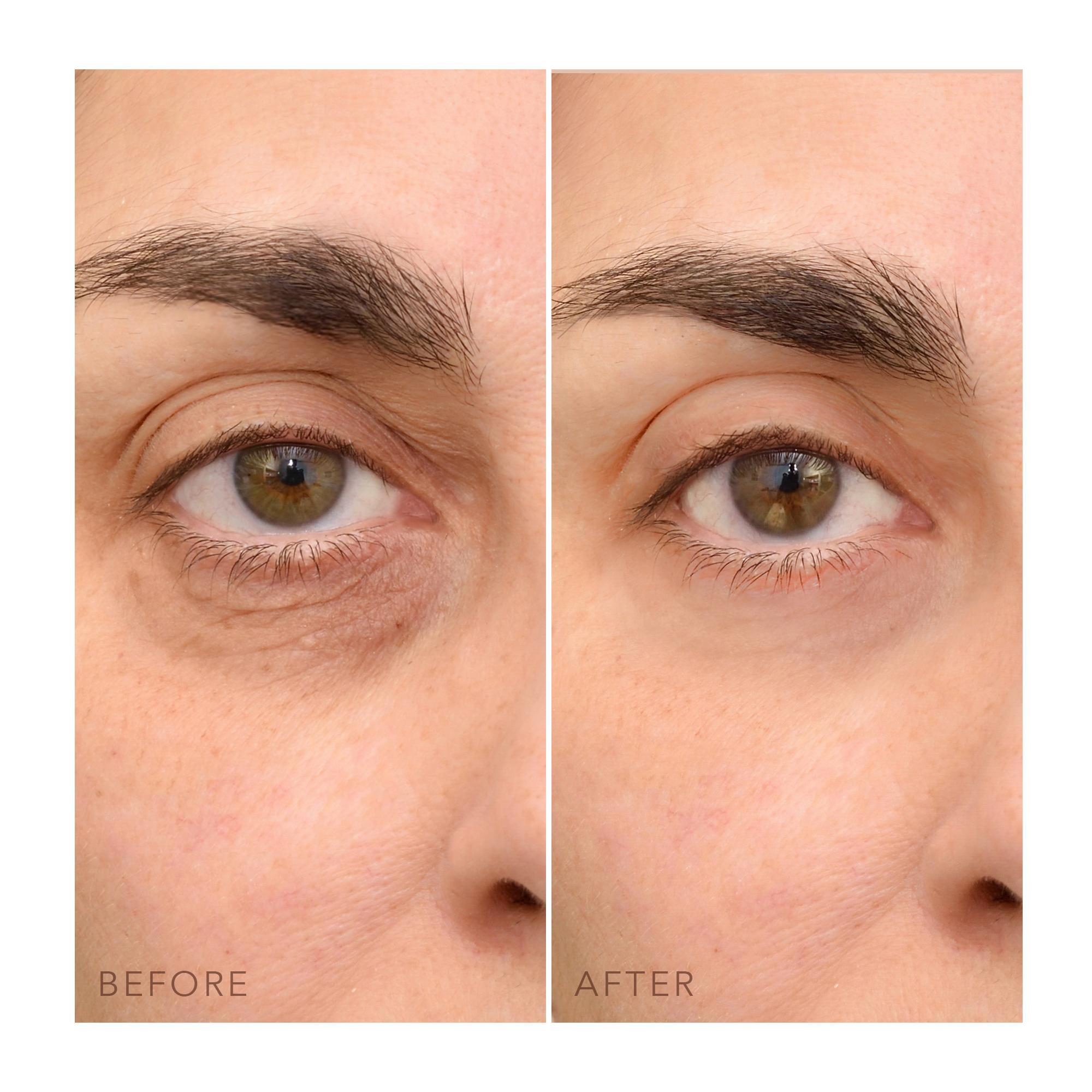 FOREO IRIS C-konsantre Aydınlatıcı Göz Kremi 15 Ml