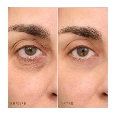  FOREO IRIS C-konsantre Aydınlatıcı Göz Kremi 15 Ml