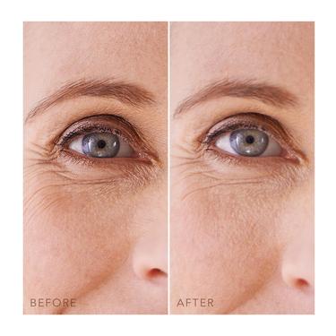  FOREO IRIS Nemlendirici Hidrojel Göz Maskesi 60'lı