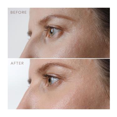  FOREO IRIS Sıkılaştırıcı Gece Göz Serumu 15 Ml