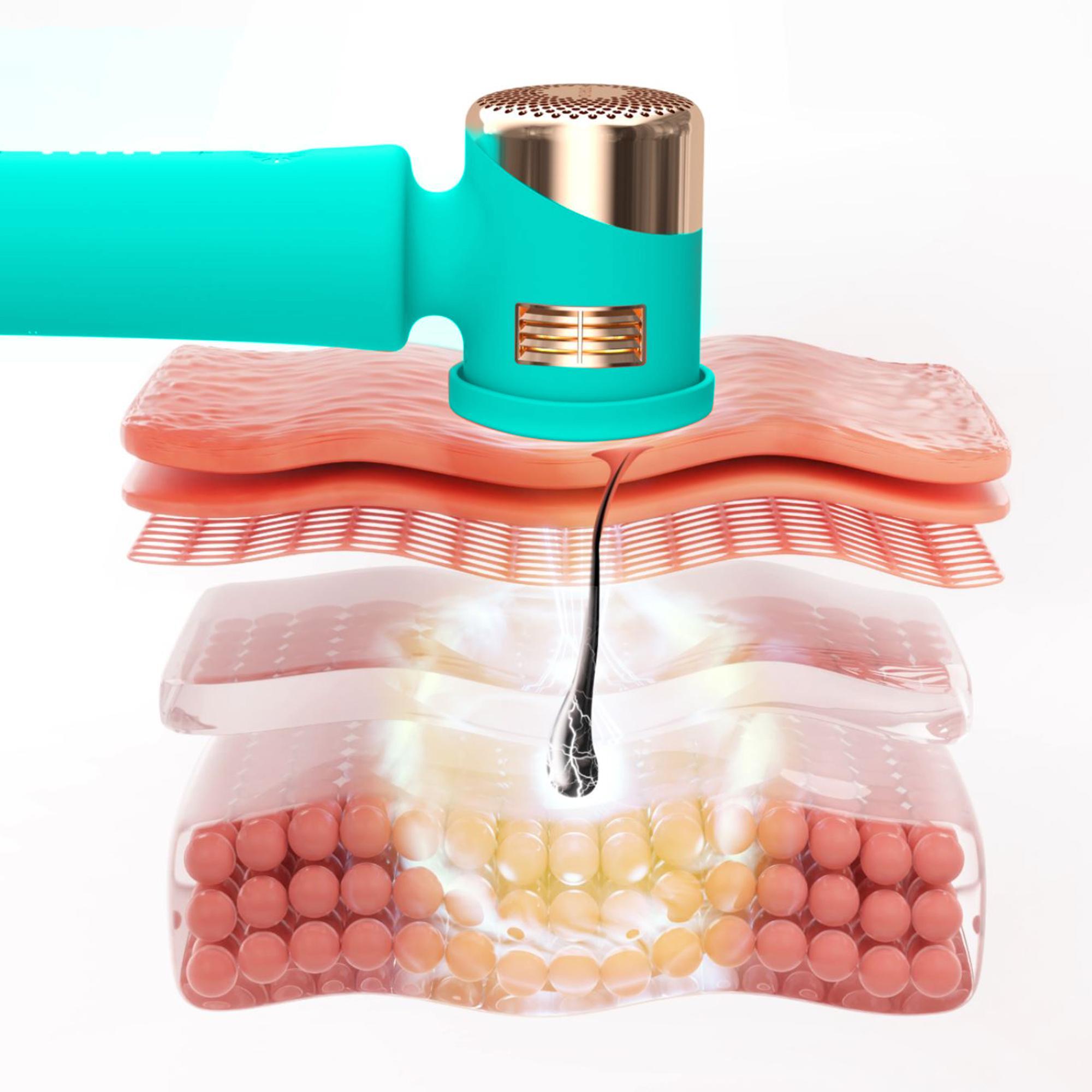 FOREO PEACH 2 - Cilt Soğutma Sistemli Kalıcı Tüy Azaltma IPL Cihazı,Mint