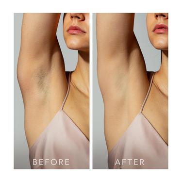  FOREO PEACH 2 - Cilt Soğutma Sistemli Kalıcı Tüy Azaltma IPL Cihazı,Mint