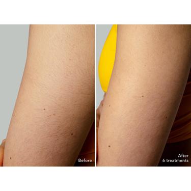  FOREO PEACH 2 Go - Cilt Soğutma Sistemli Kalıcı Tüy Azaltma IPL Cihazı, Lavender