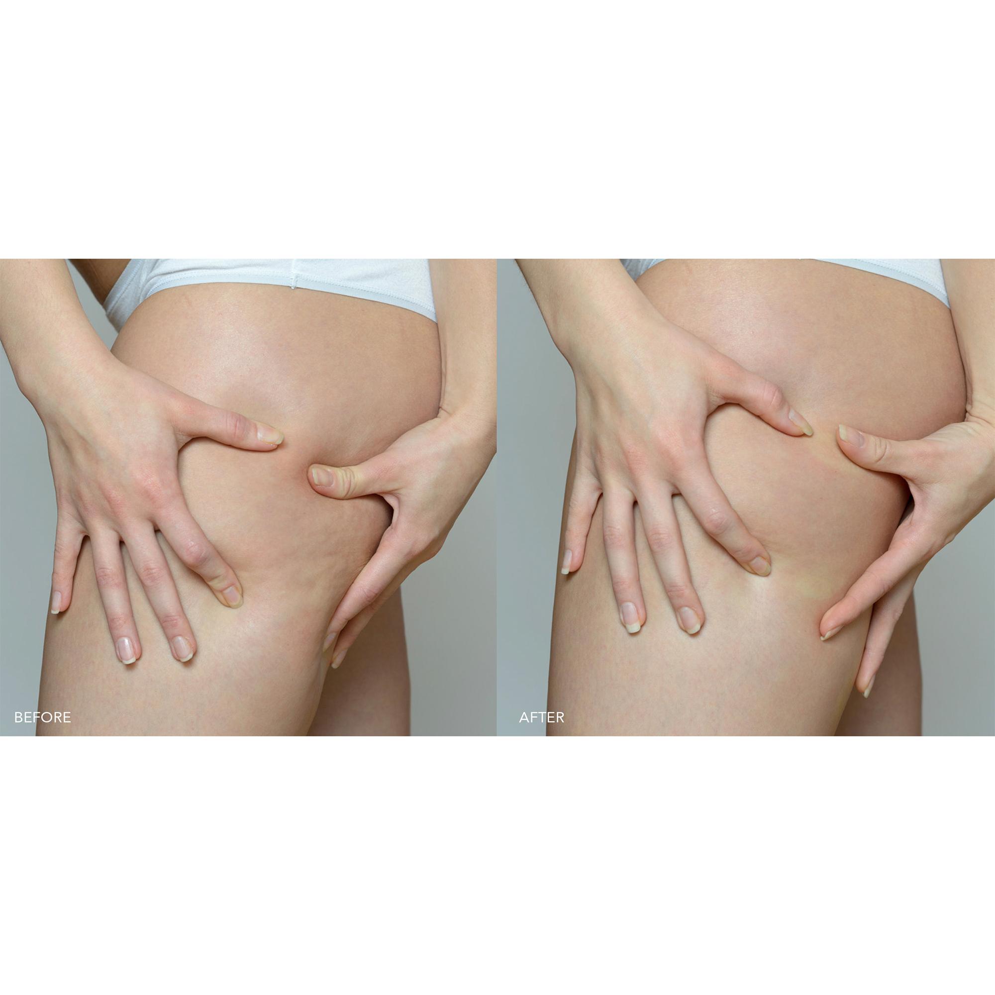 FOREO SUPERCHARGED Sıkılaştırıcı Vücut Serumu 100 ml