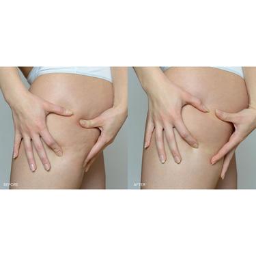  FOREO SUPERCHARGED Sıkılaştırıcı Vücut Serumu 100 ml