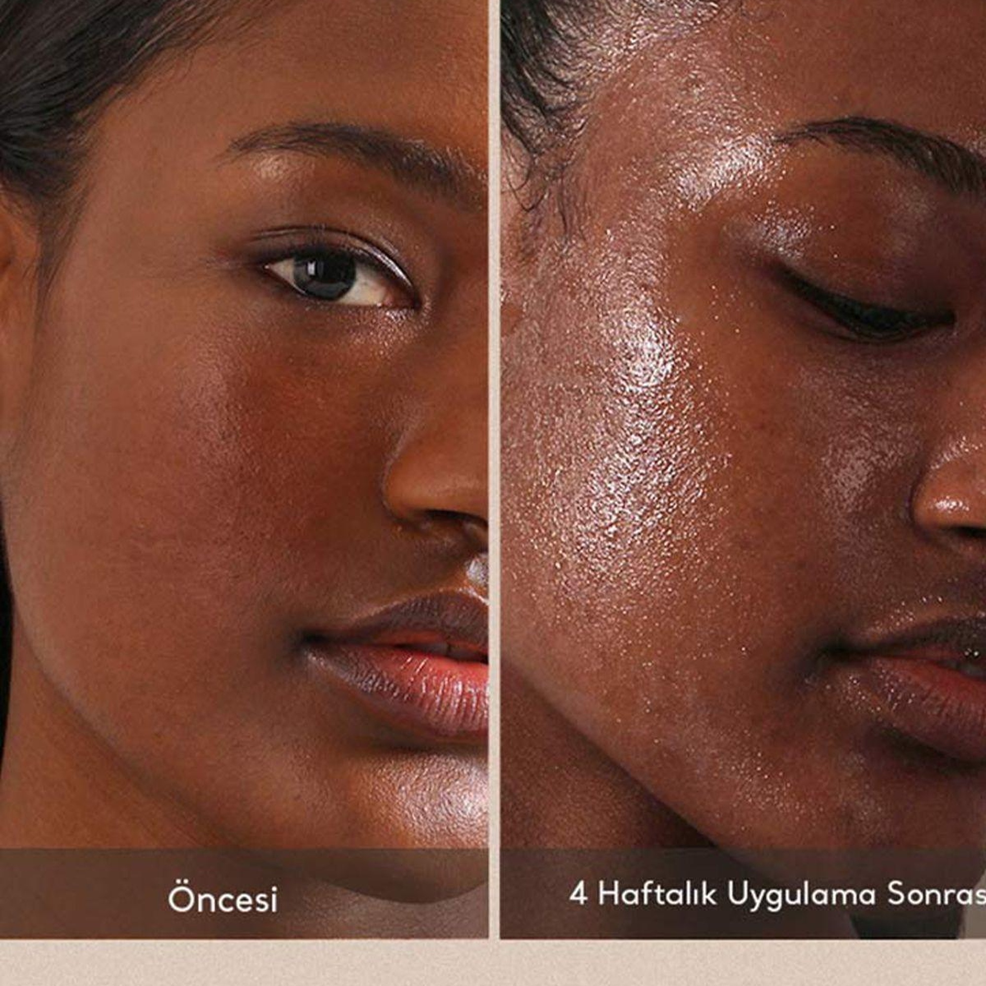 Village 11 Factory Hydro Boost Serum 50ml - Vegan Nem Bombası Yaşlanma Karşıtı Hyalüronik Asit ve Jojoba Nemlendirici Serum