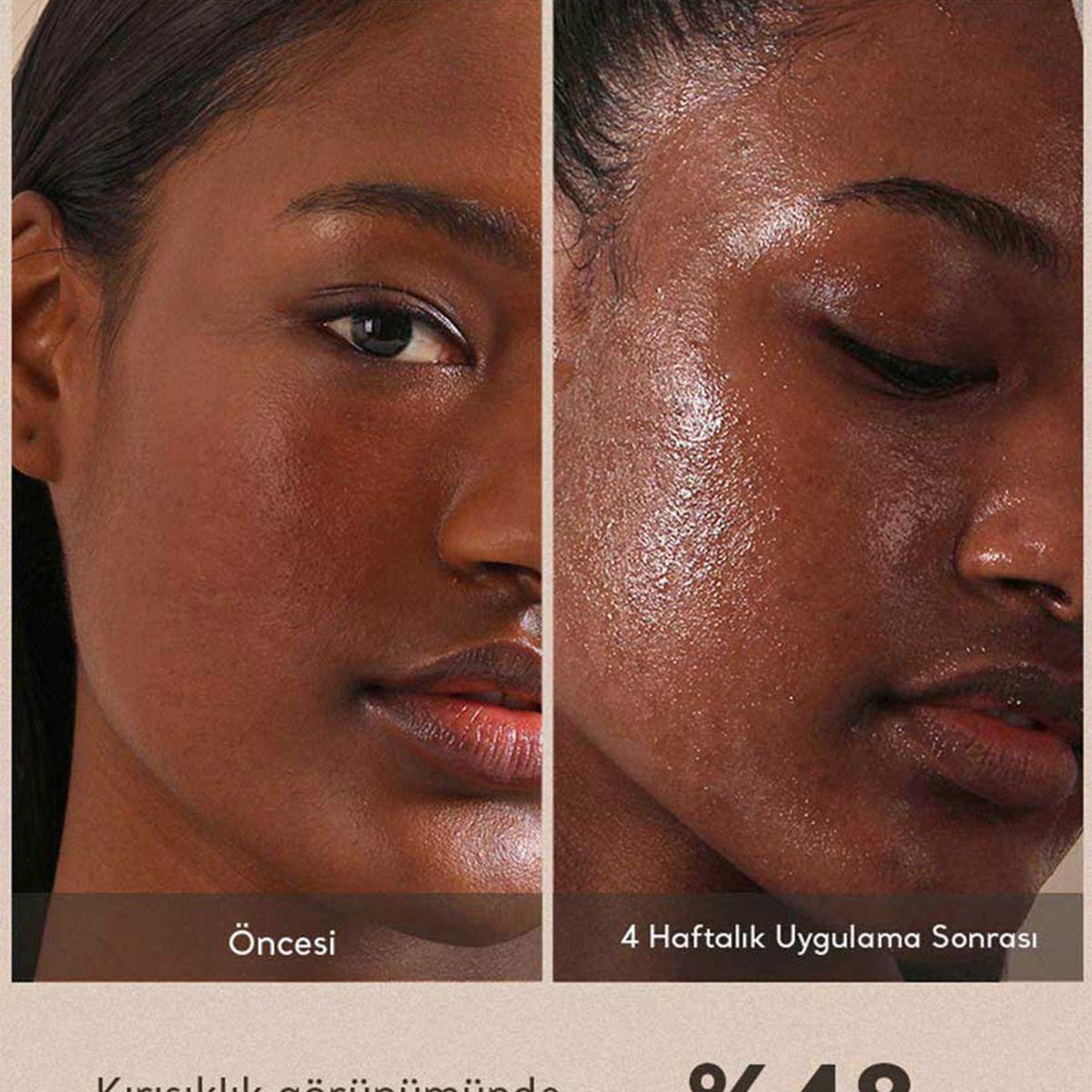 Village 11 Factory My Skin Fit BB Cream SPF 50+ PA++++ #2 Medium Ivory 20ml - Hyalüronik Asit & Cica BB Krem