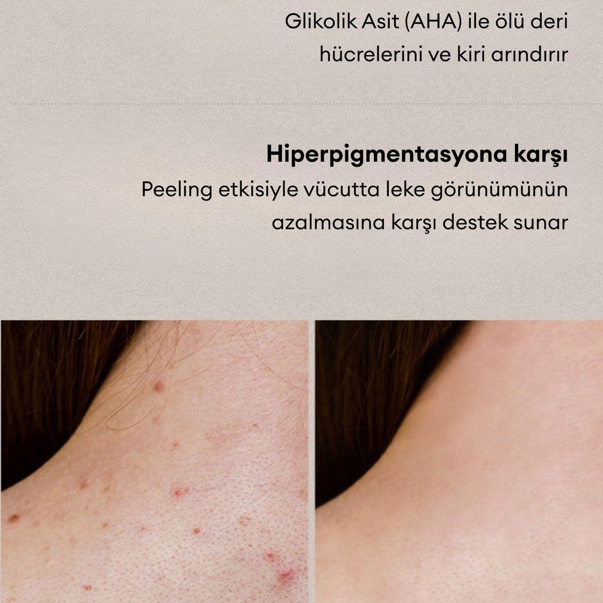 Village 11 Factory Relax Day Aha Exfoliating Body Lotion 300ml - Batık Akne Leke & Kararma Karşıtı Arındırıcı Glikolik Asit Vücut Peeling Losyonu