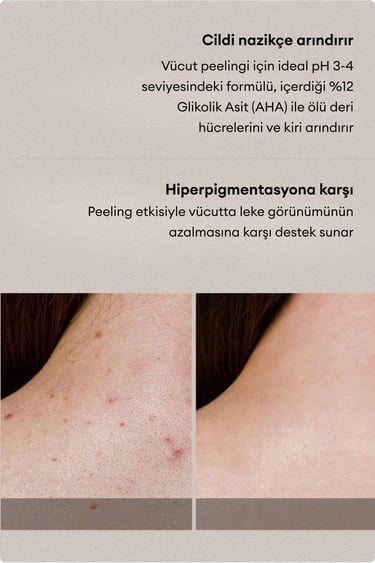  Village 11 Factory Relax Day Aha Exfoliating Body Lotion 300ml - Batık Akne Leke & Kararma Karşıtı Arındırıcı Glikolik Asit Vücut Peeling Losyonu