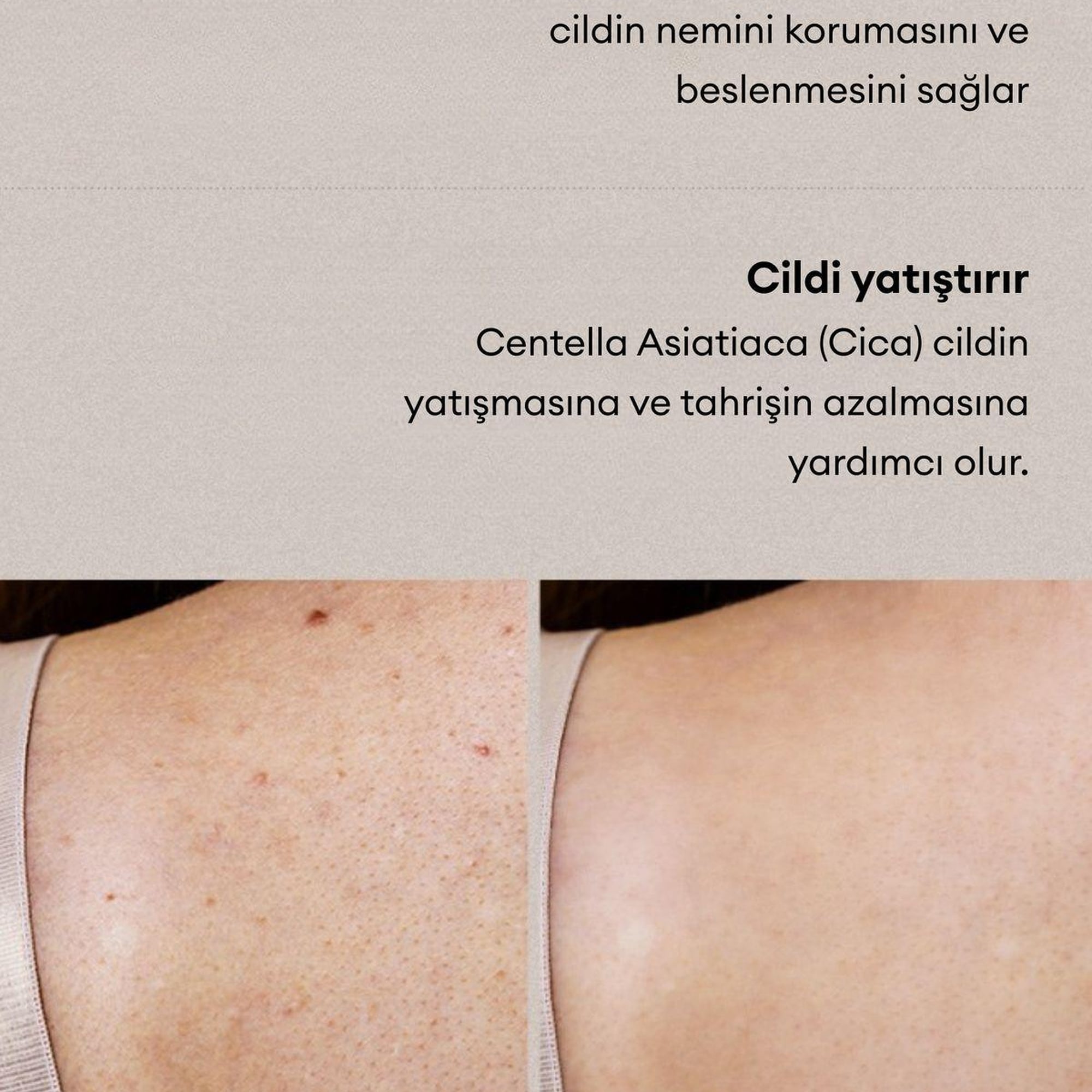 Village 11 Factory Relax Day Aha Exfoliating Body Lotion 300ml - Batık Akne Leke & Kararma Karşıtı Arındırıcı Glikolik Asit Vücut Peeling Losyonu