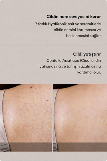  Village 11 Factory Relax Day Aha Exfoliating Body Lotion 300ml - Batık Akne Leke & Kararma Karşıtı Arındırıcı Glikolik Asit Vücut Peeling Losyonu